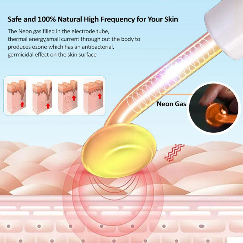 Nuvio High Frequency Acne Wand
