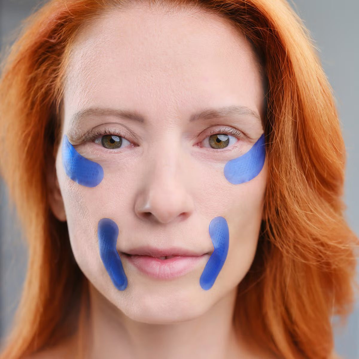 Micro-Infusion Targeted Patches